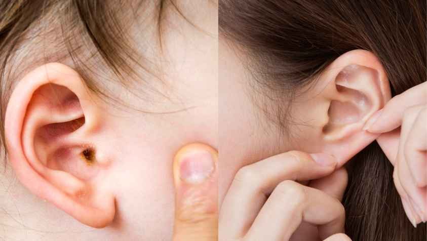 காது எப்படி சுத்தம் செய்யணும் தெரியுமா…? | How to Clean Ear at Home Naturally