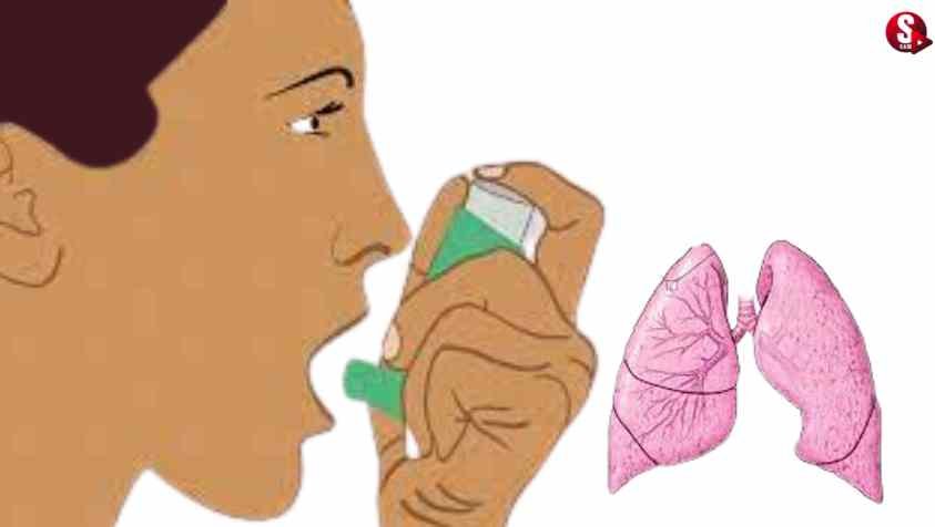 ஆஸ்துமாவை எவ்வாறு கண்டறிவது....? சிகிச்சைகள் என்னென்ன? | Asthma Diagnose in Tamil